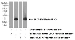 GPX7 Rabbit anti-Human, Polyclonal, Proteintech:Antibodies:Primary Antibodies