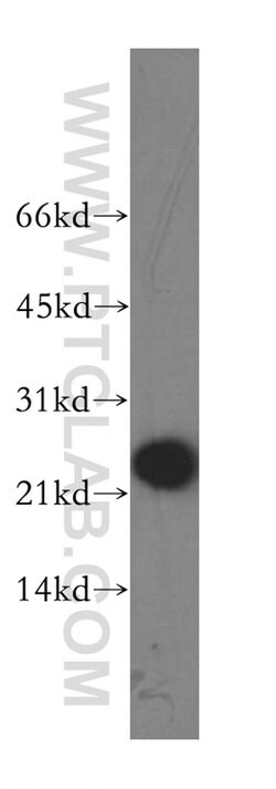 GPX7 Rabbit anti-Human, Polyclonal, Proteintech:Antibodies:Primary Antibodies