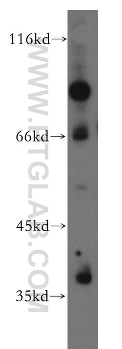 USP46 Rabbit anti-Human, Mouse, Rat, Polyclonal, Proteintech:Antibodies:Primary