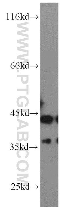 ATX3/ATXN3 Rabbit anti-Human, Mouse, Rat, Polyclonal, Proteintech:Antibodies:Primary
