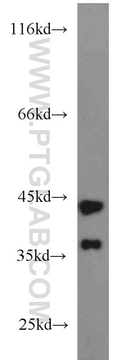 ATX3/ATXN3 Rabbit anti-Human, Mouse, Rat, Polyclonal, Proteintech:Antibodies:Primary