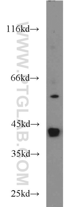 ATX3/ATXN3 Rabbit anti-Human, Mouse, Rat, Polyclonal, Proteintech:Antibodies:Primary