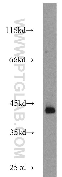 ATX3/ATXN3 Rabbit anti-Human, Mouse, Rat, Polyclonal, Proteintech:Antibodies:Primary