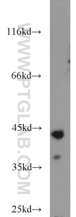 ATX3/ATXN3 Rabbit anti-Human, Mouse, Rat, Polyclonal, Proteintech:Antibodies:Primary