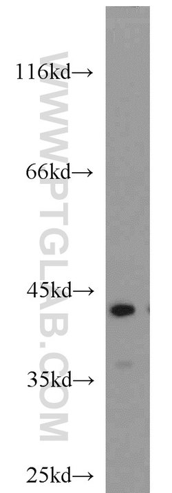ATX3/ATXN3 Rabbit anti-Human, Mouse, Rat, Polyclonal, Proteintech:Antibodies:Primary