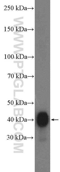 ATX3/ATXN3 Rabbit anti-Human, Mouse, Rat, Polyclonal, Proteintech:Antibodies:Primary