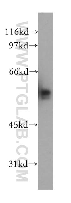 TAF7 Rabbit anti-Human, Mouse, Rat, Polyclonal, Proteintech:Antibodies:Primary