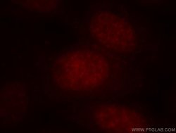 BATF Rabbit anti-Human, Mouse, Rat, Polyclonal, Proteintech:Antibodies:Primary