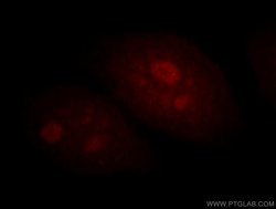 BATF Rabbit anti-Human, Mouse, Rat, Polyclonal, Proteintech:Antibodies:Primary