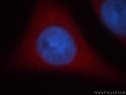 MTPN Rabbit anti-Human, Mouse, Rat, Polyclonal, Proteintech 150 &mu;L;