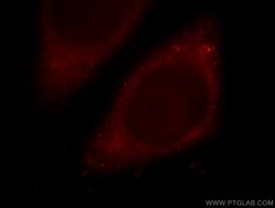 MTPN Rabbit anti-Human, Mouse, Rat, Polyclonal, Proteintech 150 &mu;L;