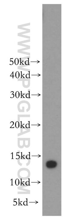 MTPN Rabbit anti-Human, Mouse, Rat, Polyclonal, Proteintech 150 &mu;L;