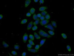 EEF2K Rabbit anti-Human, Mouse, Rat, Polyclonal, Proteintech:Antibodies:Primary