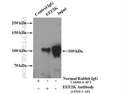 EEF2K Rabbit anti-Human, Mouse, Rat, Polyclonal, Proteintech:Antibodies:Primary