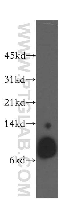 Beta-2-microglobulin Rabbit anti-Human, Mouse, Polyclonal, Proteintech:Antibodies:Primary