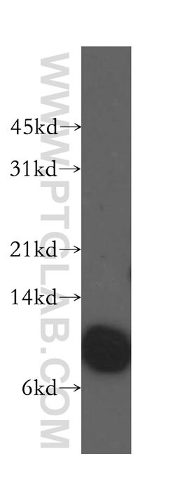 Beta-2-microglobulin Rabbit anti-Human, Mouse, Polyclonal, Proteintech:Antibodies:Primary