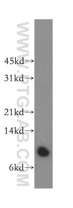 Beta-2-microglobulin Rabbit anti-Human, Mouse, Polyclonal, Proteintech:Antibodies:Primary
