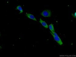 Beta-2-microglobulin Rabbit anti-Human, Mouse, Polyclonal, Proteintech:Antibodies:Primary