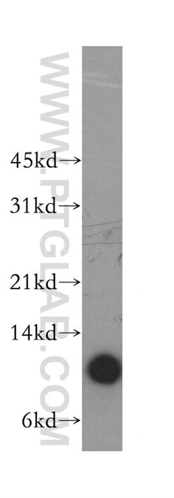 Beta-2-microglobulin Rabbit anti-Human, Mouse, Polyclonal, Proteintech:Antibodies:Primary