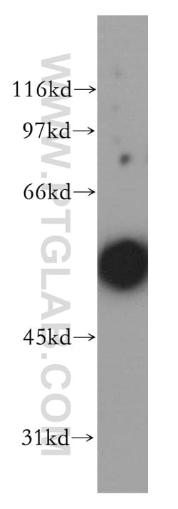 CHRNA5 Rabbit anti-Human, Mouse, Rat, Polyclonal, Proteintech 150 &mu;L;