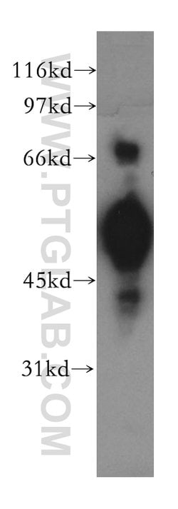 CHRNA5 Rabbit anti-Human, Mouse, Rat, Polyclonal, Proteintech 150 &mu;L;