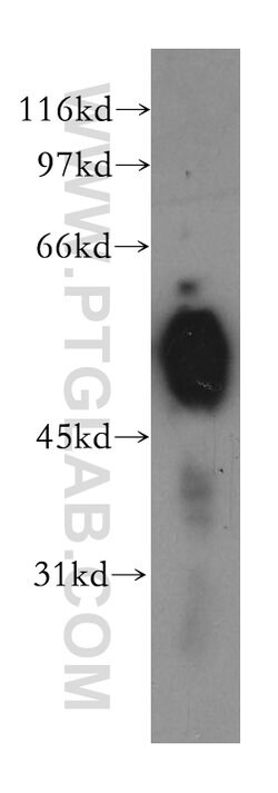 CHRNA5 Rabbit anti-Human, Mouse, Rat, Polyclonal, Proteintech 150 &mu;L;
