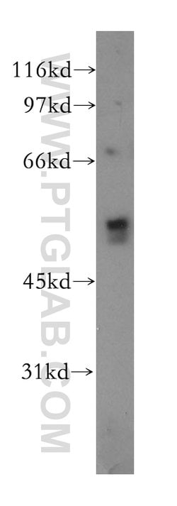 CHRNA5 Rabbit anti-Human, Mouse, Rat, Polyclonal, Proteintech 150 &mu;L;