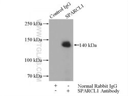 SPARCL1 Rabbit anti-Human, Polyclonal, Proteintech:Antibodies:Primary Antibodies