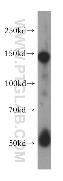 SPARCL1 Rabbit anti-Human, Polyclonal, Proteintech:Antibodies:Primary Antibodies