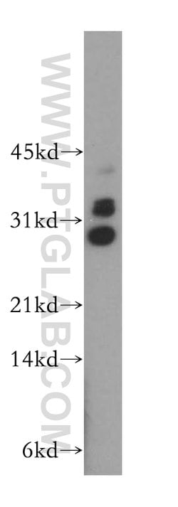 TRBV5-4 Rabbit anti-Human, Polyclonal, Proteintech 150 &mu;L; Unconjugated:Antibodies,
