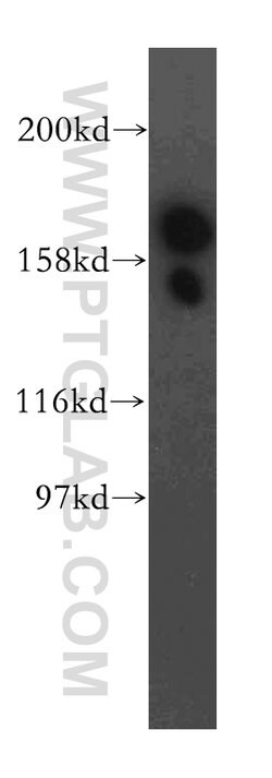 EIF5B Rabbit anti-Human, Mouse, Rat, Polyclonal, Proteintech:Antibodies:Primary