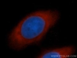 EIF5B Rabbit anti-Human, Mouse, Rat, Polyclonal, Proteintech:Antibodies:Primary