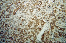 EIF5B Rabbit anti-Human, Mouse, Rat, Polyclonal, Proteintech:Antibodies:Primary