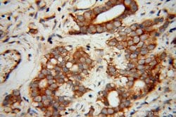 EIF5B Rabbit anti-Human, Mouse, Rat, Polyclonal, Proteintech:Antibodies:Primary