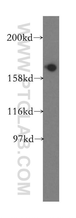 EIF5B Rabbit anti-Human, Mouse, Rat, Polyclonal, Proteintech:Antibodies:Primary