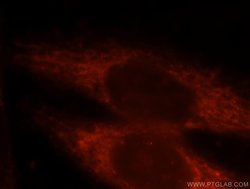 TDRKH Rabbit anti-Human, Mouse, Rat, Polyclonal, Proteintech:Antibodies:Primary