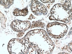 Proenkephalin-A Rabbit anti-Human, Polyclonal, Proteintech:Antibodies:Primary
