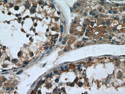 Proenkephalin-A Rabbit anti-Human, Polyclonal, Proteintech:Antibodies:Primary