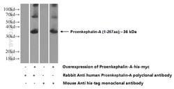 Proenkephalin-A Rabbit anti-Human, Polyclonal, Proteintech:Antibodies:Primary