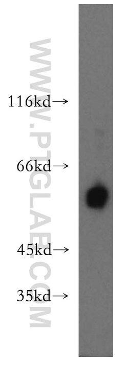 P2RX4 Rabbit anti-Human, Mouse, Polyclonal, Proteintech 150 &mu;L; Unconjugated:Antibodies,