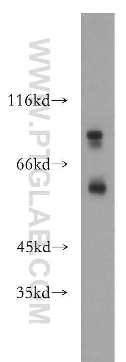 P2RX4 Rabbit anti-Human, Mouse, Polyclonal, Proteintech 150 &mu;L; Unconjugated:Antibodies,