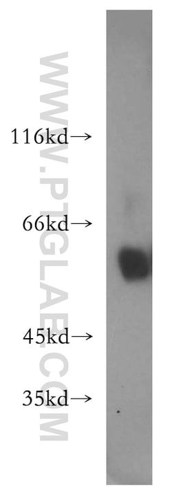 P2RX4 Rabbit anti-Human, Mouse, Polyclonal, Proteintech 150 &mu;L; Unconjugated:Antibodies,