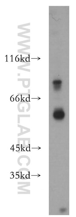 P2RX4 Rabbit anti-Human, Mouse, Polyclonal, Proteintech 150 &mu;L; Unconjugated:Antibodies,