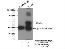 PAK6 Rabbit anti-Human, Mouse, Rat, Polyclonal, Proteintech:Antibodies:Primary
