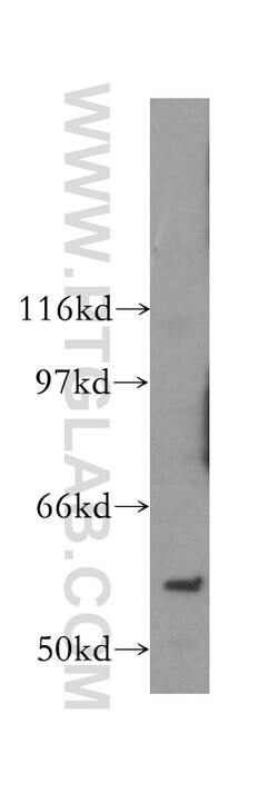 PAK6 Rabbit anti-Human, Mouse, Rat, Polyclonal, Proteintech:Antibodies:Primary