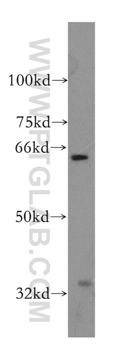 PAK6 Rabbit anti-Human, Mouse, Rat, Polyclonal, Proteintech:Antibodies:Primary