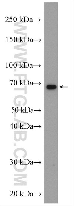 PAK6 Rabbit anti-Human, Mouse, Rat, Polyclonal, Proteintech:Antibodies:Primary
