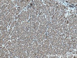 PDSS2 Rabbit anti-Human, Mouse, Rat, Polyclonal, Proteintech 150 &mu;L;