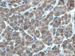 PDSS2 Rabbit anti-Human, Mouse, Rat, Polyclonal, Proteintech 150 &mu;L;