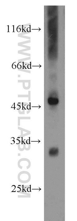 PDSS2 Rabbit anti-Human, Mouse, Rat, Polyclonal, Proteintech 150 &mu;L;
